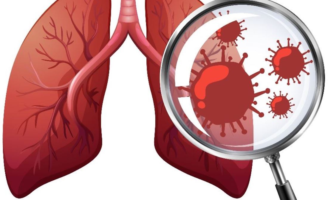 क्षयरोग निवारण : लक्ष्य भेट्न सार्क राष्ट्रहरूलाई चुनौती  